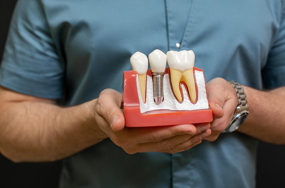 Are You a Candidate for Dental Crown? What Dentists Look For