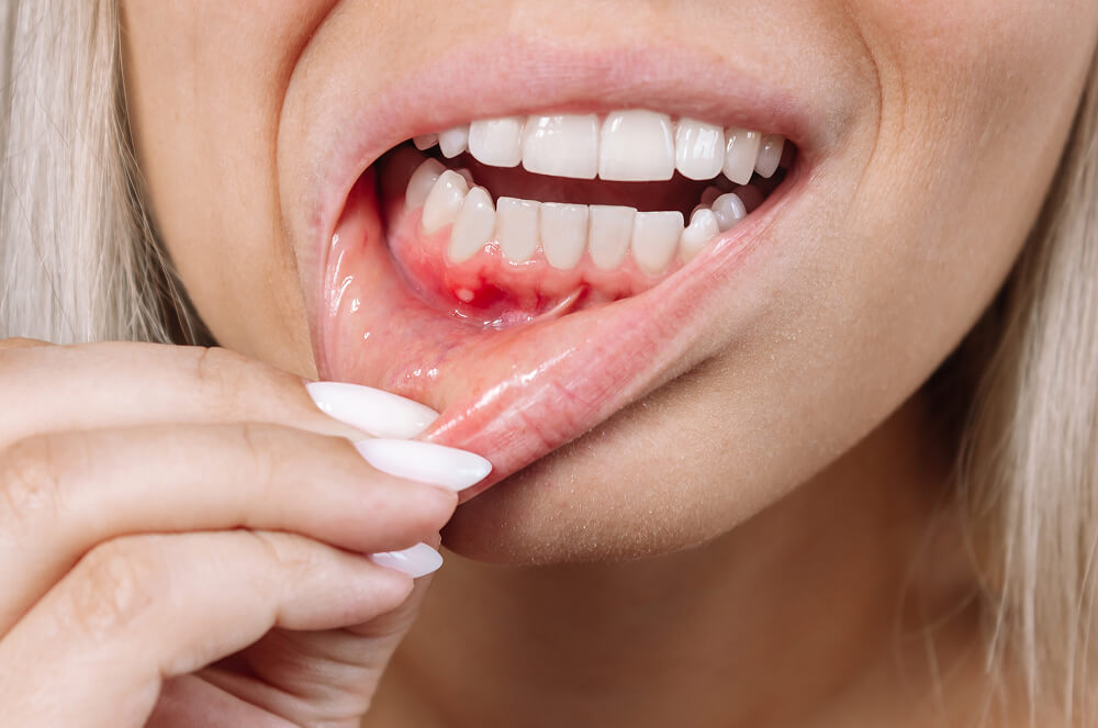Gum Health 101: How to Prevent Recession, Sensitivity, and Tooth Loss